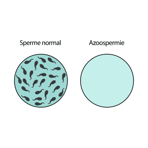 Traitement naturel de l’azoospermie